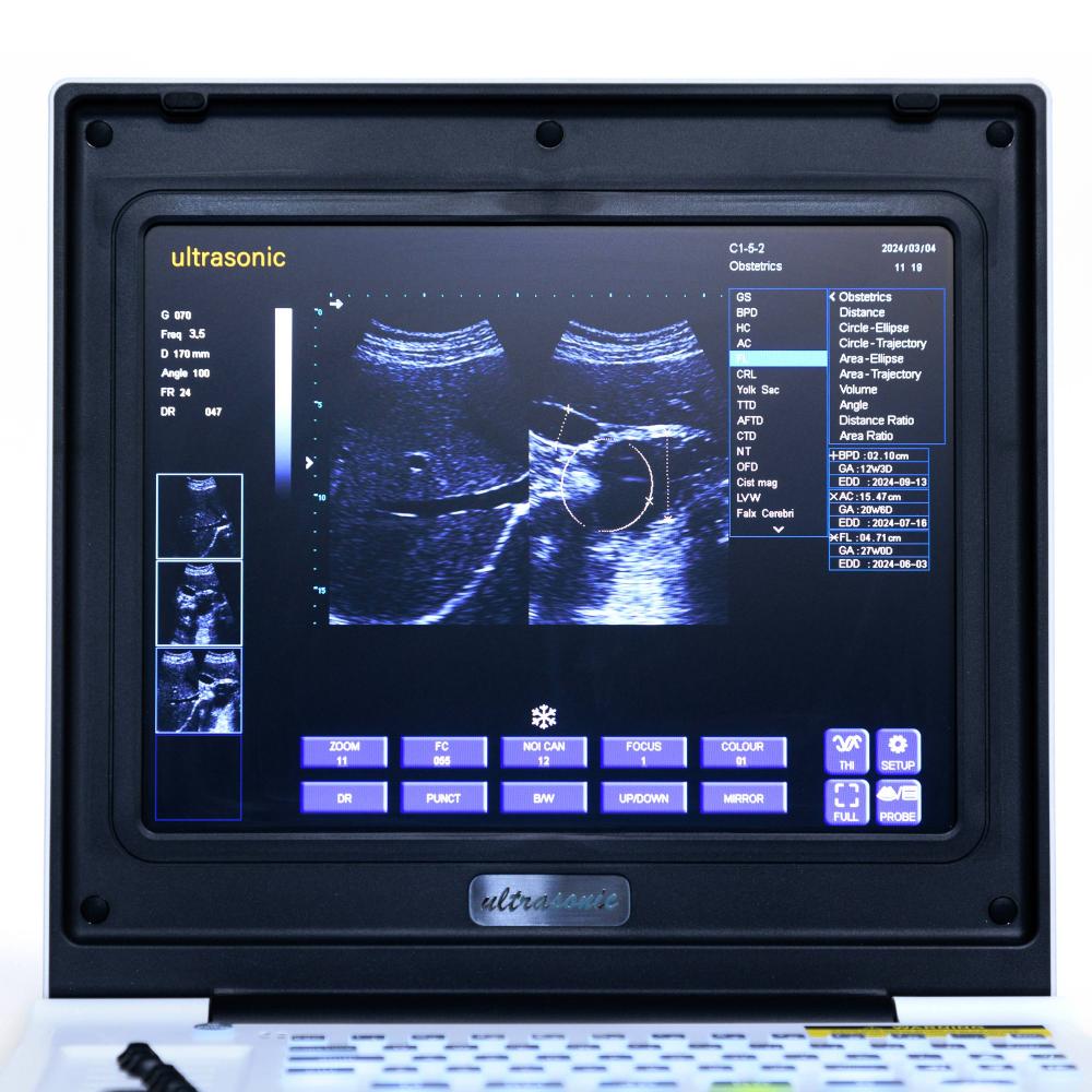 Ультрагукавы экран ноўтбука 7 Laptop Ultrasound Screen 7