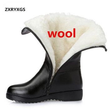 ZXRYXGS Brand Boots Plush Wool Genuine Leather Shoes Woman Warm Snow Boots 2020 Plus Size Winter Shoes Knight Boots Women Boots