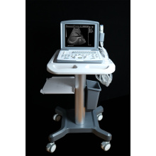 Portable B ultrasound scanner for abdomen