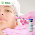 Injection PLLA Dermal Filler Hyaluronic Acid Winkles Removal