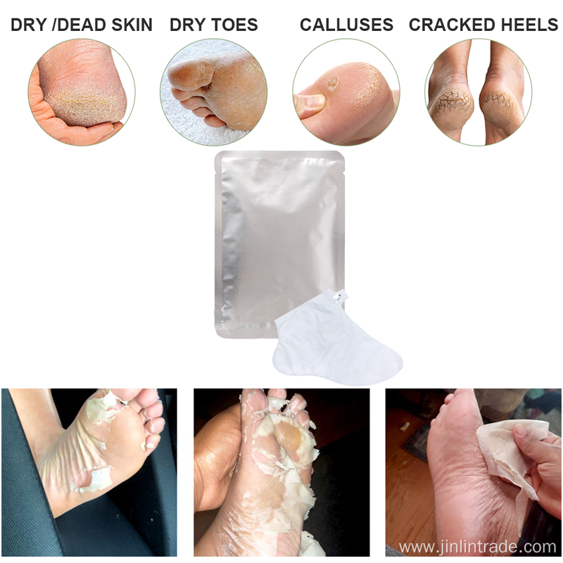 remove dead skin nourish exfoliating foot mask peeling