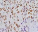 Immunohistochemistry(IHC)