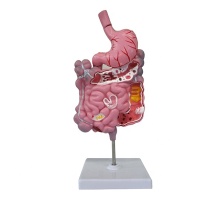 Human Diseased Abnormal Digestive System Anatomy Model