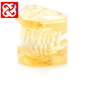 Soft Gum Model Light Color Removable Dental Teeth Demonstration