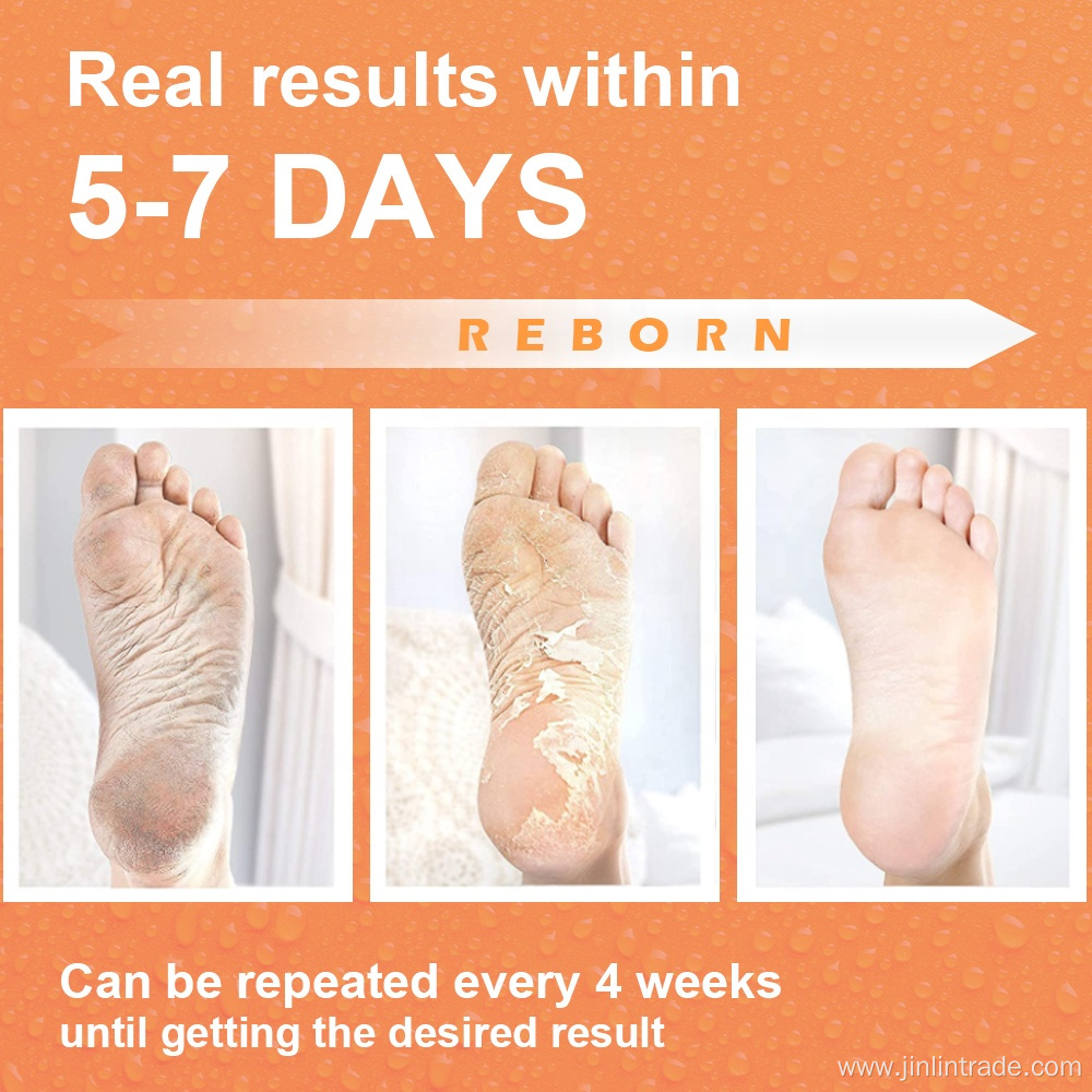 Oem Remove Dead Skin Heels Foot Peeling Mask