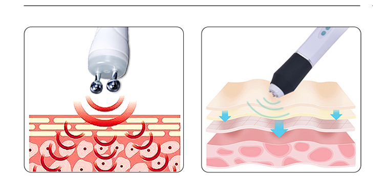 Microdermabrasion Facial Peel