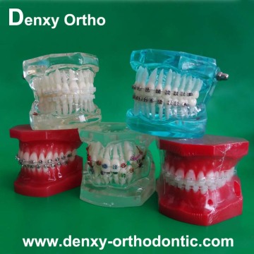 Dental Orthodontic Standard dental orthodontic model