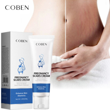 Private Label Skin Repair Anti-Stretch Mark Cream
