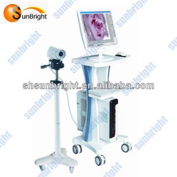 Colposcope Examination System