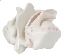 Enlargement of the ethmoid bone 1: 4