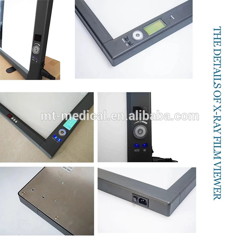 Medical LED X Ray Film Illuminator Film Viewer for Hospital