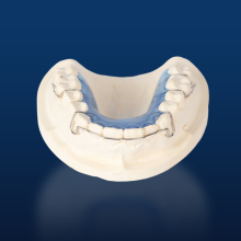 Dental Teeth Ortho Appliance for Jaw Alignment
