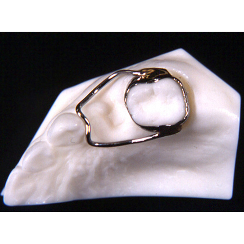 Dental Space Retainer Band Looped