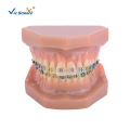 歯の解剖学モデル歯科矯正モデル