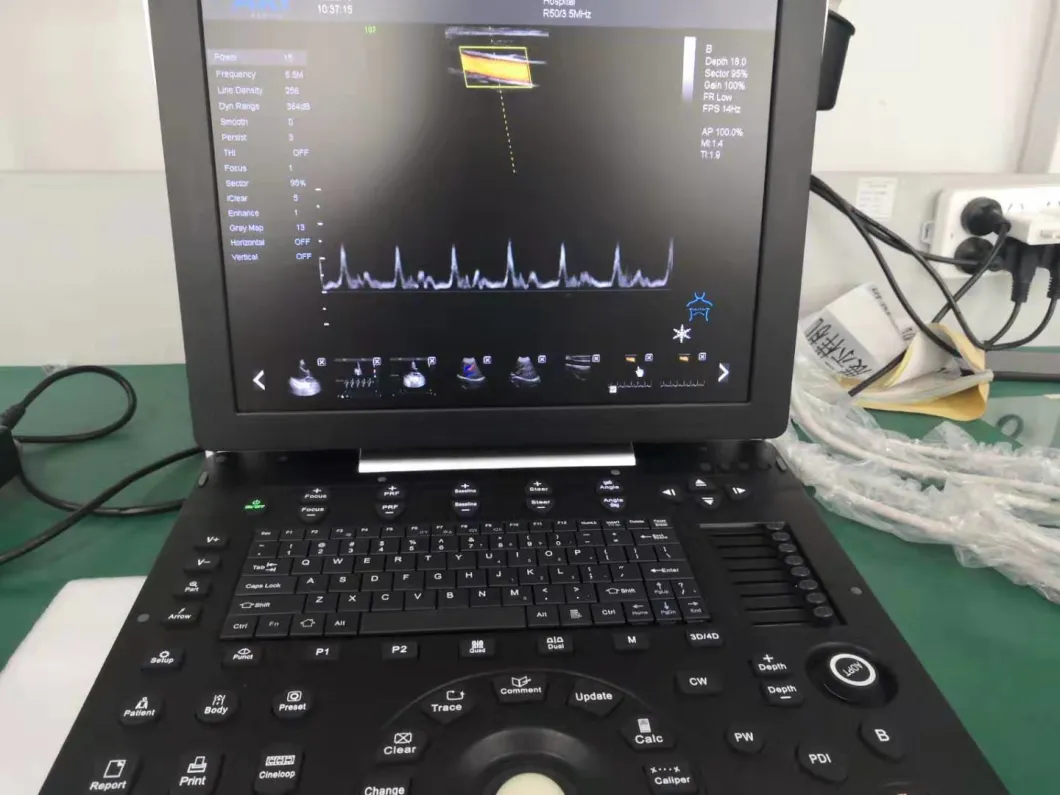 4D Color Ultrasound Doppler Probe Machine