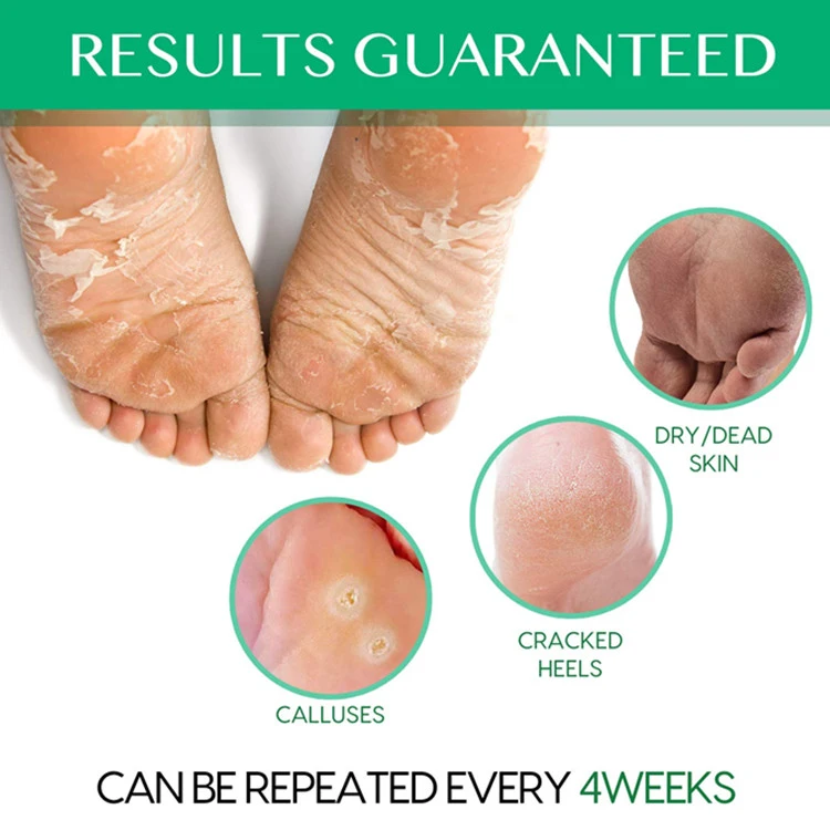 Natural Exfoliating Cracked Heels & Dead Skin Foot Peel Mask