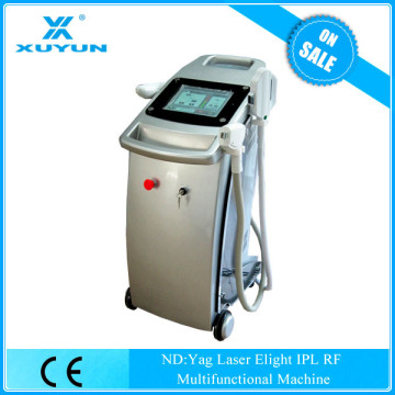 customer-oriented smooth pregnancy striae rf facial machine on sale