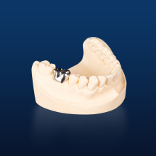 Customized Full Metal Crown