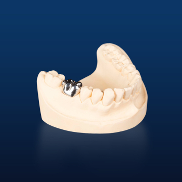 Customized Full Metal Crown