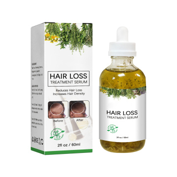 Wholesale Natural Herbal Organic Scalp Elixir with Rosemary for Hair Growth
