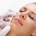 Derma acne assusta o tratamento com PLLA