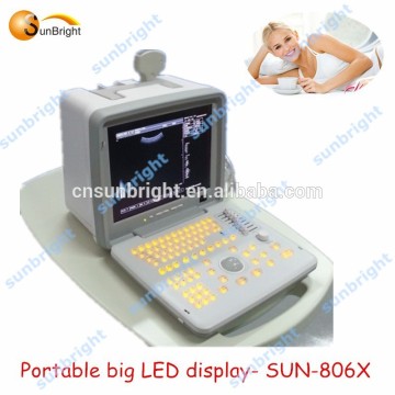 Portable ultrasound /Price for portable ultrasound machine