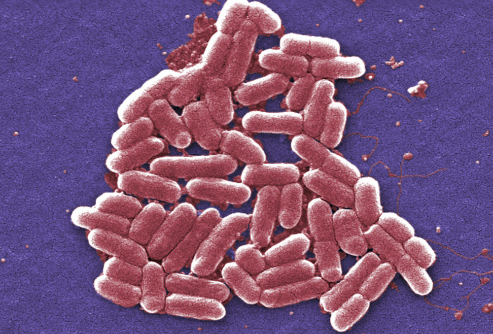 0716_e-coli-1000x678