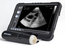 SmartScan A best ultrasound machine for goats