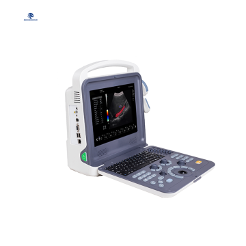 color doppler ultrasound scanner K2