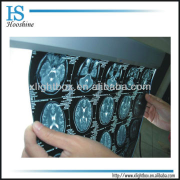 Dental X-ray film viewer/Medical X-ray equipment