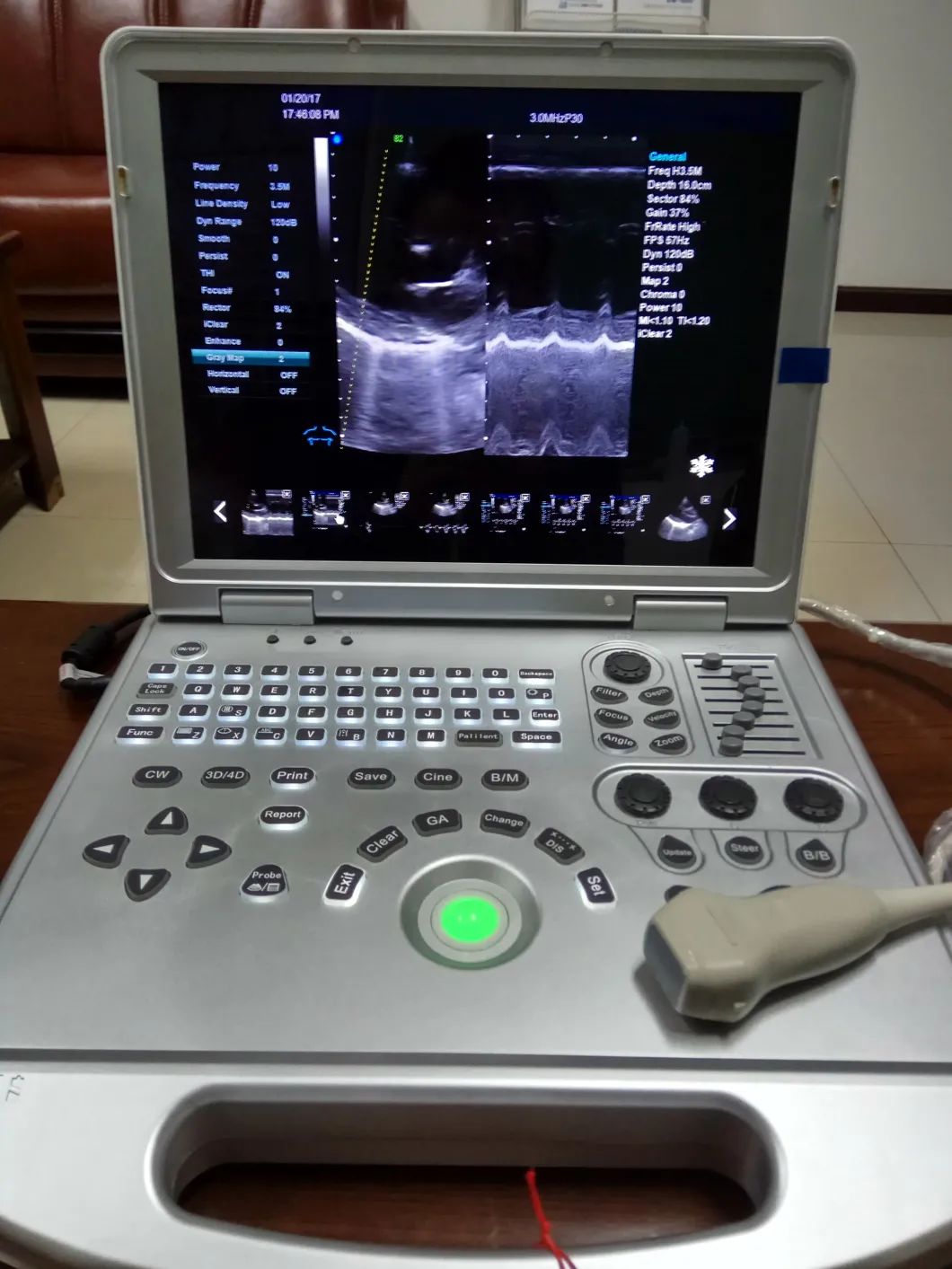 Veterinary Multiparameter Patient Monitor with Etco2 Parameter