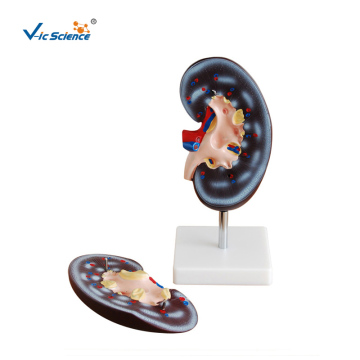 Kidney Anatomy Medical Teaching Model 2 Parts