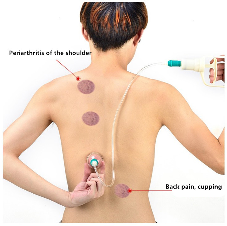 Hot sell Chinese traditional hijama cupping sets with ABS Big pump