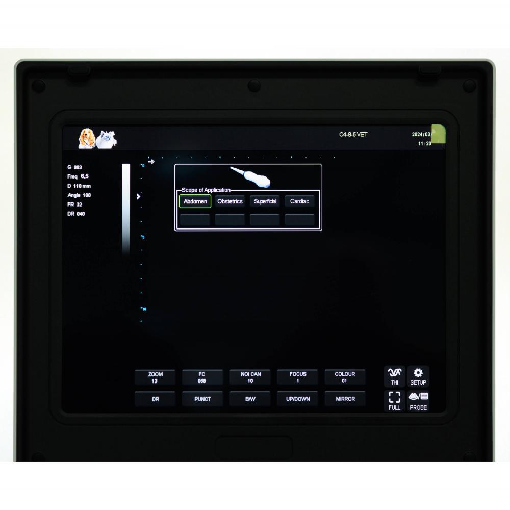 Ультрагукавы экран ноўтбука 12 Laptop Ultrasound Screen 12