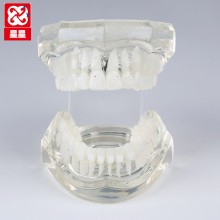 Ceramic Bracket Orthodontic Dental Models