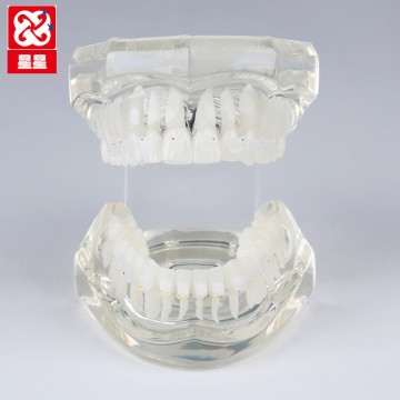 Ceramic Bracket Orthodontic Dental Models