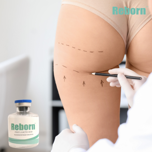 Non-Surgery Body Contour Treatment For Buttocks Enhancement