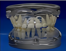 Transparent Milk Teeth Development Model