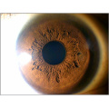 Fotocamera scanner per iris iridologia 12mp
