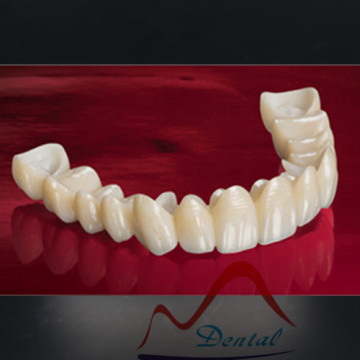 CAD/CAM full zirconia crown and bridge