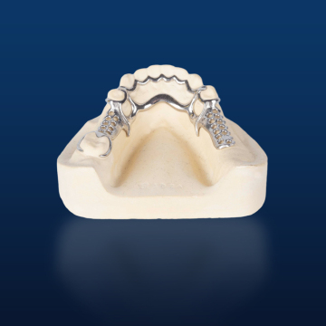 Bego Metal Partial Denture