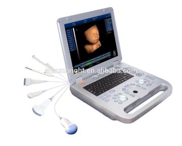 All digital color Doppler ultrasound