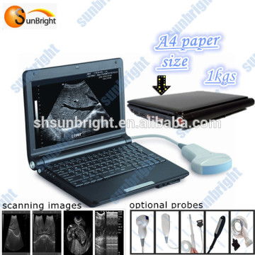 Medical Equipment Laptop Full Digital Ultrasound