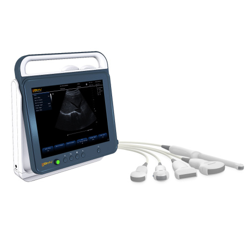 Mobile Diagnostic Digital Laptop Ultrasound Scanner B / W with Convex Linear