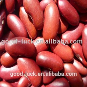 British dark red kidney beans 2015
