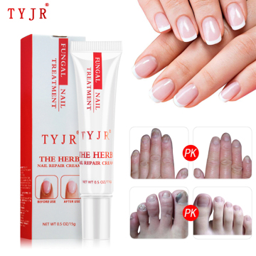 Fungal Nail Repair Cream Herbal Nail Fungus Curve Treatment Anti Bacteria Onychomycosis Paronychia Anti Fungal Toenail Care