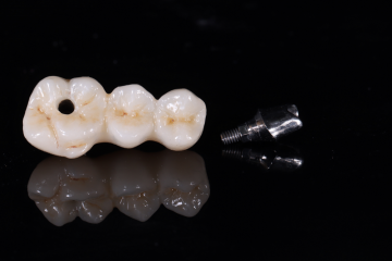 Zirconia Implant bridge