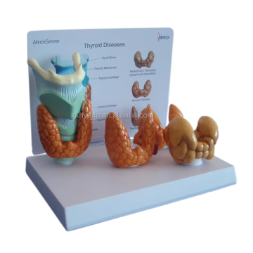 High Quality Human Anatomical Medical Model for Thyroid Diseases and Laryngeal Pathology