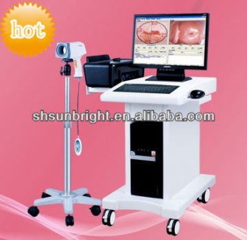 digital colposcope digital imaging system