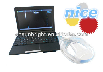 ultrasound scanner portable laptop